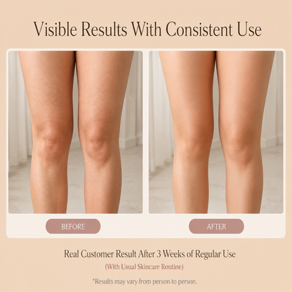 Before and after comparison of legs with text indicating visible results with consistent use.